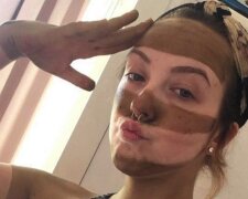 V důsledku nudy slečna udělala doma pruhované opálení a přitáhla tak pozornost médií