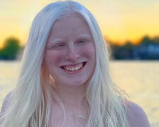 Dívka otevřela oči a překvapila své followerů: proč má dívka takovou barvu očí