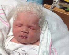 Internet sleduje život tohoto výjimečného chlapečka: narodil se s úplně šedivými vlasy