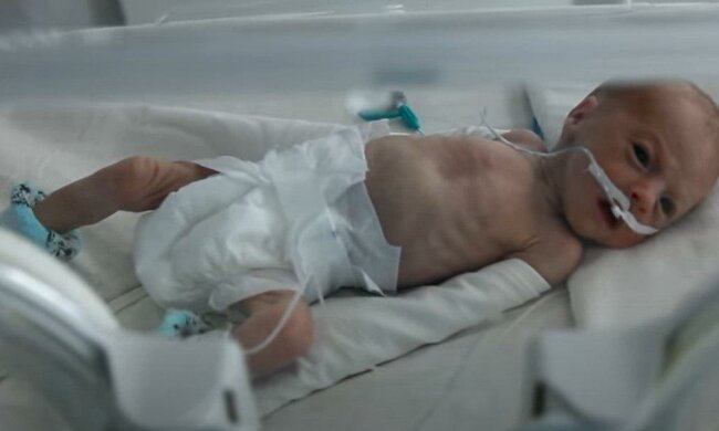 Holčička se narodila s hmotností asi 500 gramů: maminka po celou dobu fotila své předčasné dítě a jak nyní vypadá