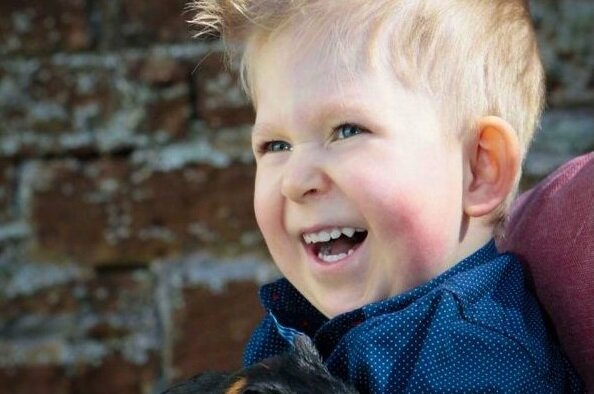 V Británii se narodil chlapec bez mozku: jeho osud po 7 letech